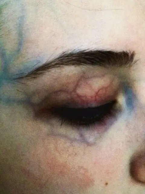 In my veins